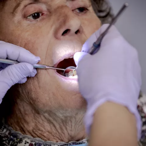 Senior at the dentist