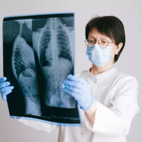 Tuberculosis Information for Healthcare Providers banner