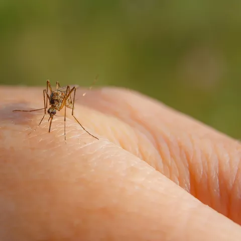 A hand with a mosquito on it