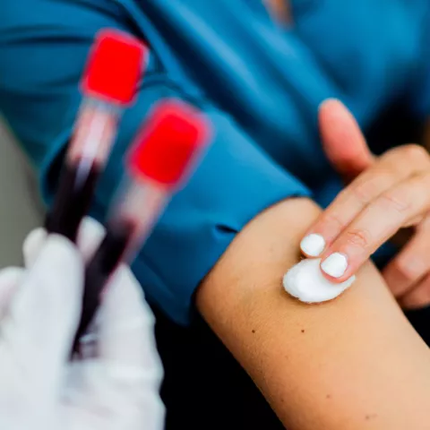 Close-up of patient woman after blood test