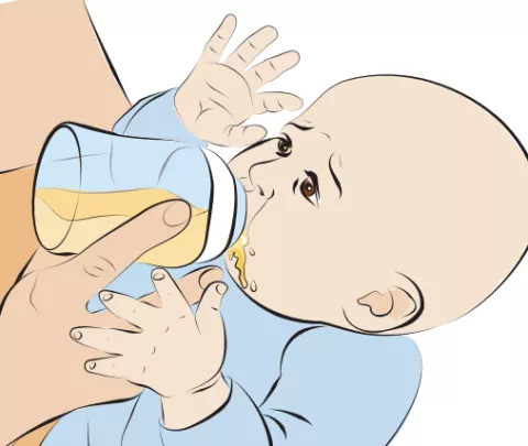An illustration of a bottle-feeding stressed infant.