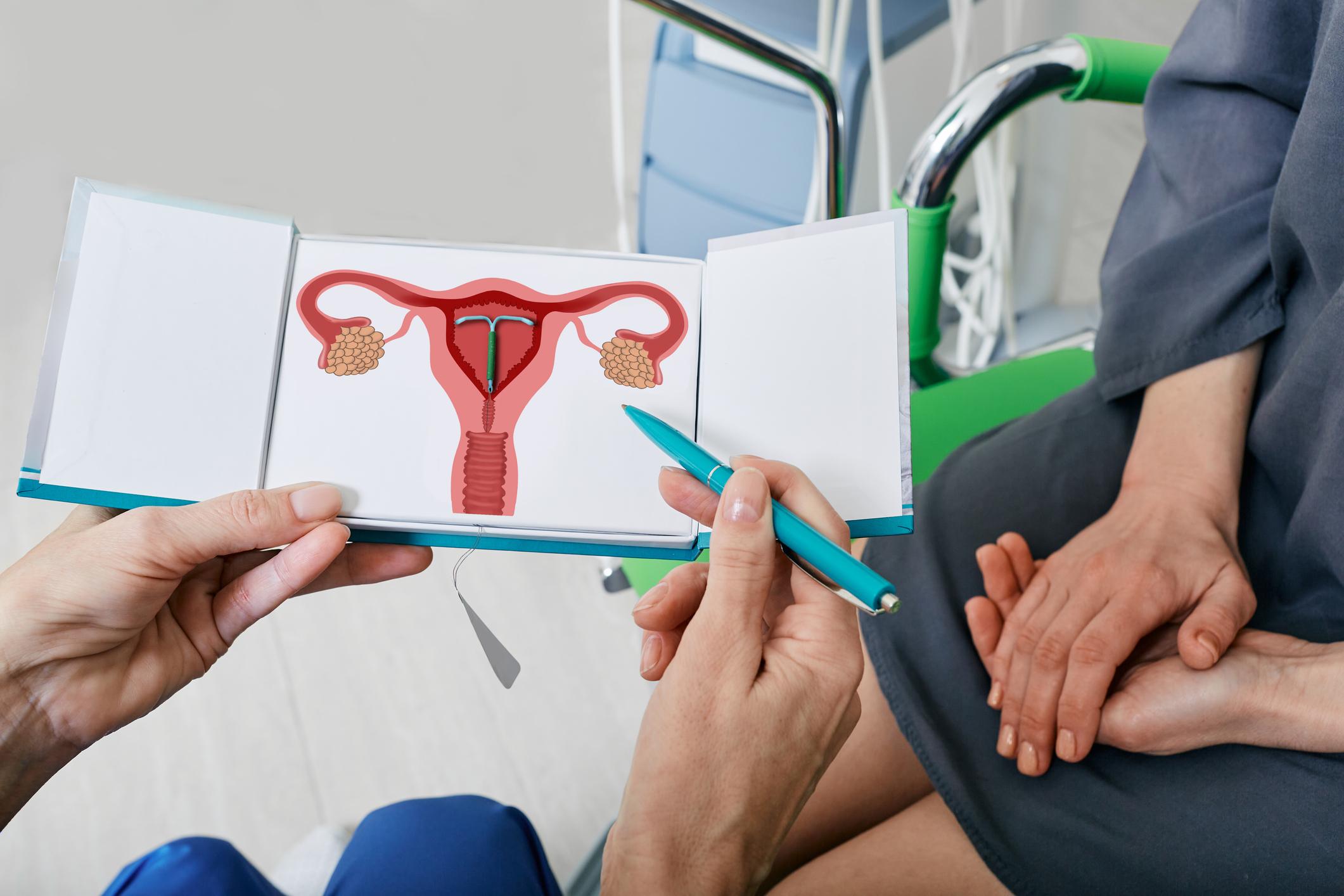 gynecologist showing female patient intrauterine contraceptive device or coil to prevent pregnancy while consultation